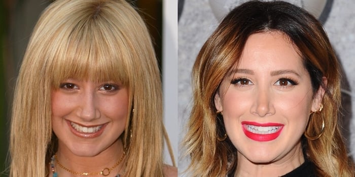 Ashley Tisdale's nose before her rhinoplasty procedure in 2005 and after at a holiday party in December 2019