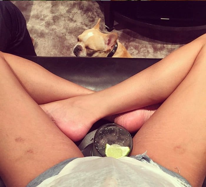 Chrissy Teigen posted a selfie showcasing the stretch marks on her thighs
